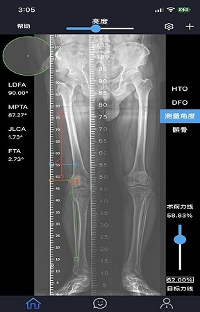 华保膝望 v1.7.4